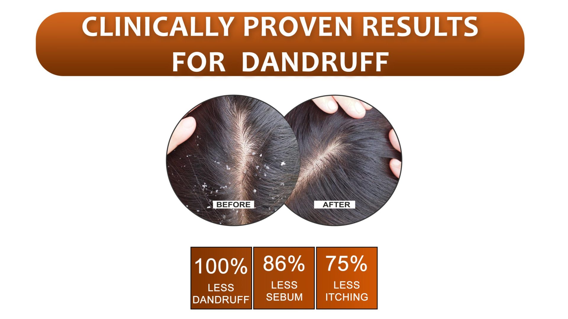 Dandruff Control Shampoo Banner 5